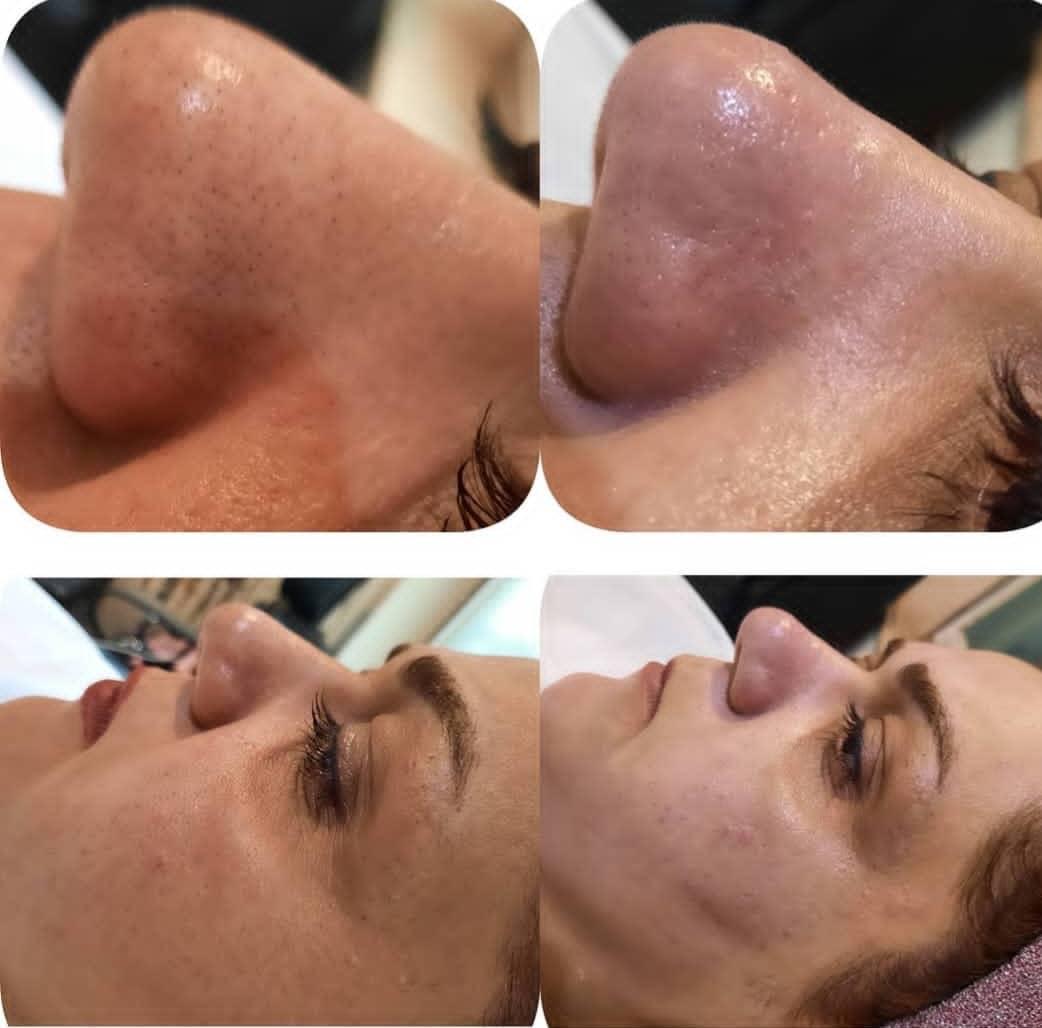 پاکسازی و مراقبت پوست